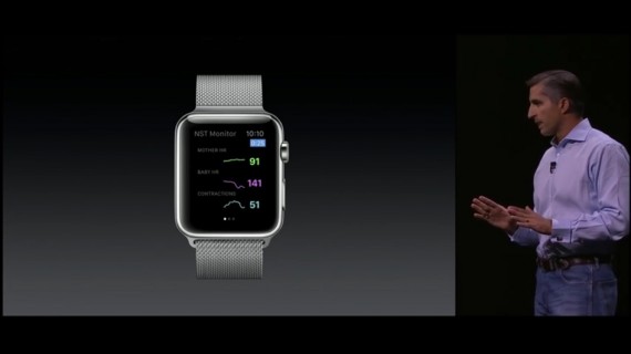 Apple Watch update 2015